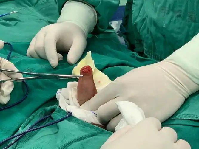 男生下面流出来白色粘稠物怎么办 跳d放里面开最大