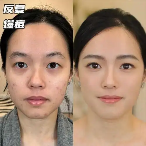 长期化妆和长期素颜哪一个皮肤更好几组对比图告诉你