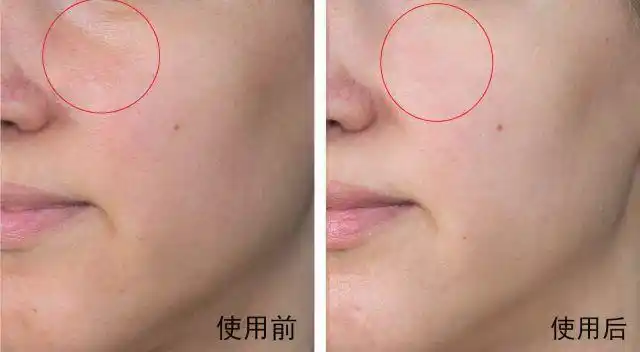 "复活"熬夜肌!补水,保湿,去暗沉,缩毛孔,改善熬夜干燥蜡黄皮肤于一身!