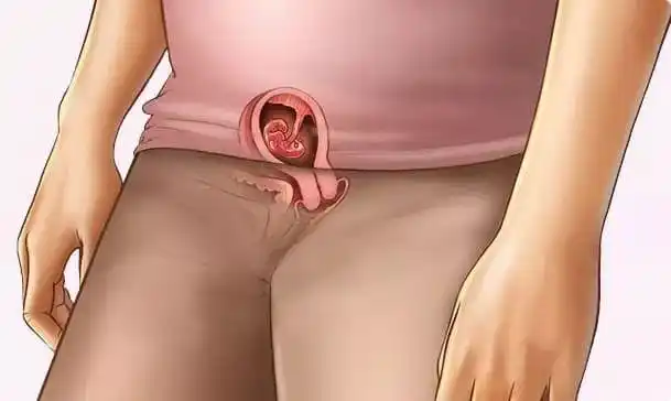 腹部尚未明显 - 子宫的大小略有增加,并且没有上升.