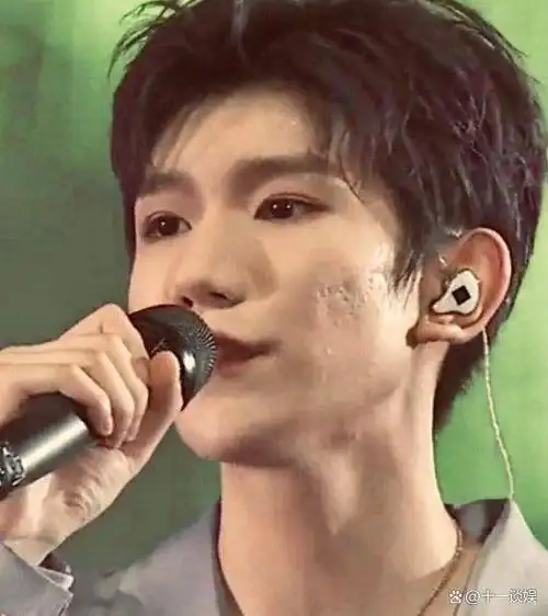 王源电影节红毯状态翻车,浓妆掩盖不住痘坑,眼神憔悴显沧桑