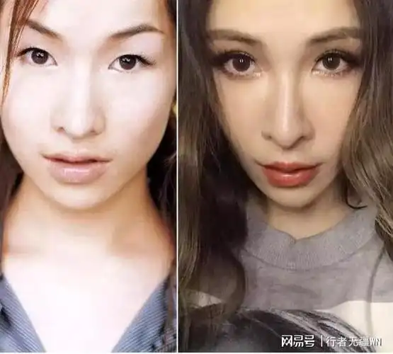 萧亚轩现状脸颊凹陷双眼无神头发凌乱情绪低落和男友分手了