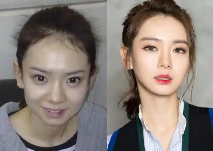 娱乐圈有哪些成整容标杆的明星虽然人糊但颜值是真的高