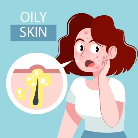 06-17手绘卡通女子油性皮肤问题矢量素材时间:06-17创意卡通女子油性