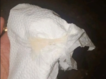 感觉4,点状出血或粉红色白带排卵期还有一个表现,那就是由于体内雌