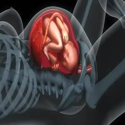 孕产说:37周了,宝宝偏小2周多,会不会推后出生?