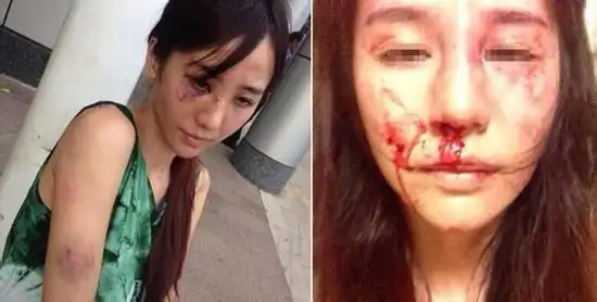 我做的这件事彻底激怒了老公,愤怒的他对我痛下毒手