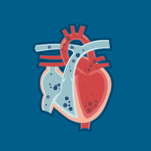 h5中不健康心脏的动态示意