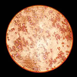 显微镜观察细菌图片