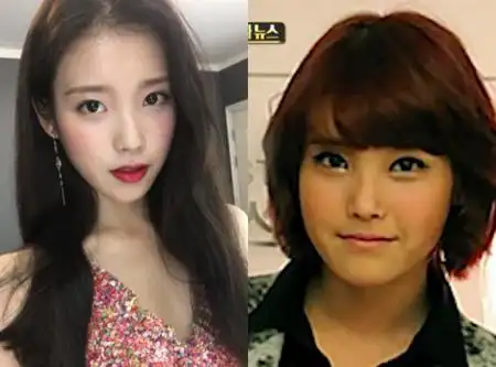 记者揭iu李智恩整容了吗iu刚出道时曾被流出一张在正颚手术医院合照的