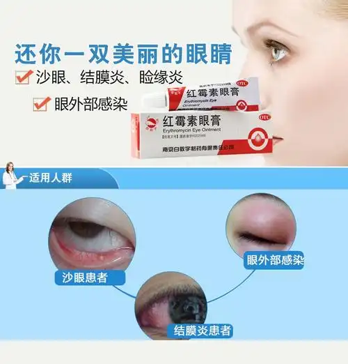 白敬宇红霉素眼膏2g 沙眼眼外感染眼睑炎 眼药膏 1盒