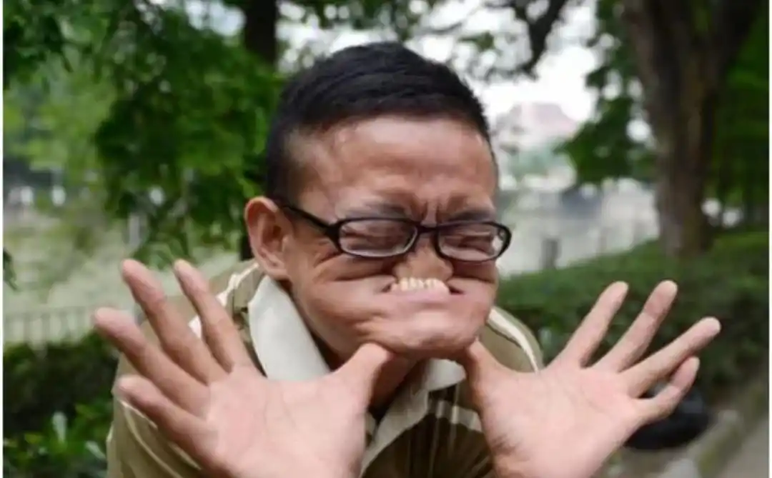 最奇葩吉尼斯世界纪录世界上最丑的人还是中国人特别像首富