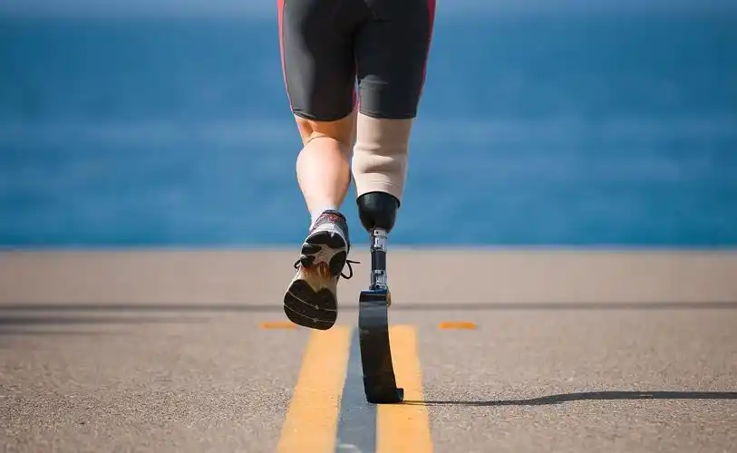 如何检验小腿假肢装配是否合适