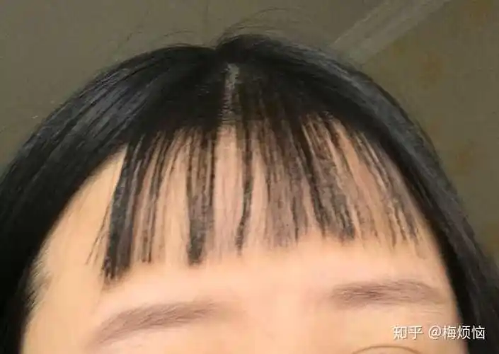 网红刘海剪失败了怎么办?