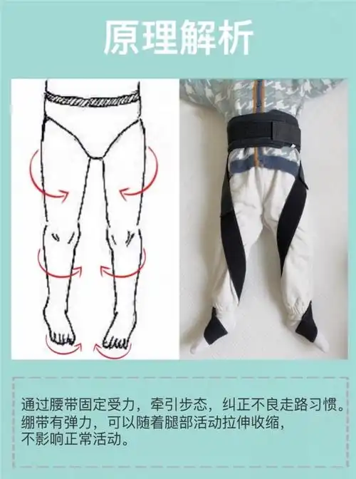 适用儿童内八字矫正器宝宝脚尖朝内走路姿势纠正足内旋内翻外八矫正带
