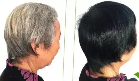 74洗头发加点它白发变黑发不伤头皮不伤发2