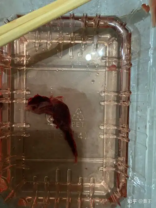 提醒一下:排出后一直畏寒头疼头晕的感觉,所以保暖很重要,附上排出的