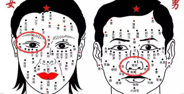 3种"巨富"痣,男人发财,女人显贵,万里挑一的好命
