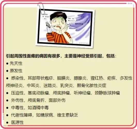 【健康知识三】周围性面神经麻痹