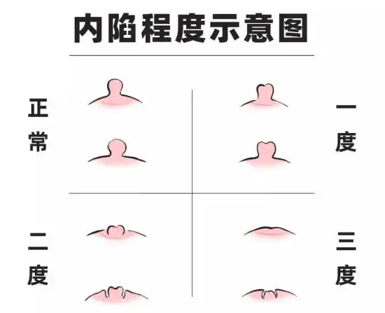 但是这个小揪揪不挤也罢_乳头_乳房_宝宝