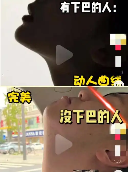 没下巴的人是直线,图1我赶紧检测一下我自己,长得太像没下巴的人了,脸