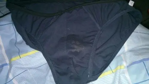 内裤上白色的是啥?