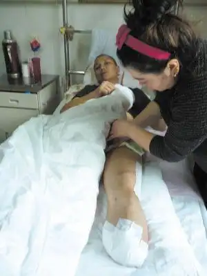 左小腿已被截肢的居拉提躺在病床上.