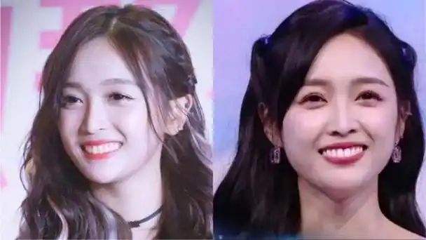 整牙惨变毁容!吴宣仪新剧《郎君不如意》开播,美容牙齿再成关注点