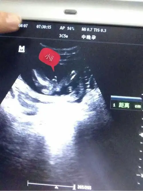 热 我姐的男宝b超图片 很清晰有么有 让我羡慕嫉妒爱