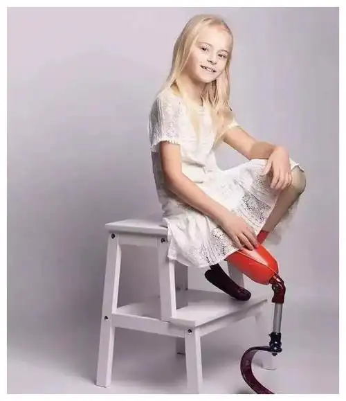 9岁小女孩天生没有腿走t台美哭观众看见脸就忘了她的腿