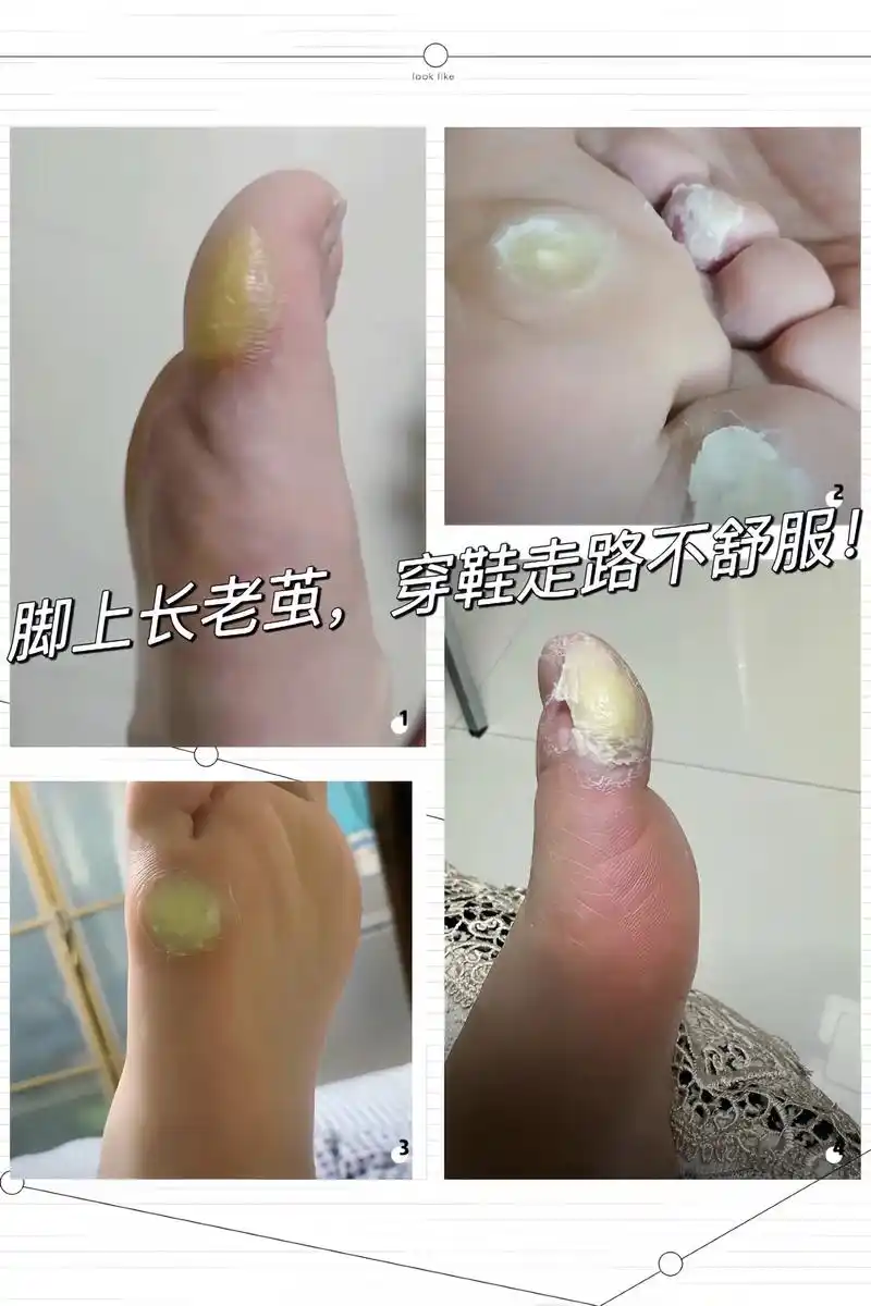 使用方法: 1.第一次使用前 - 抖音