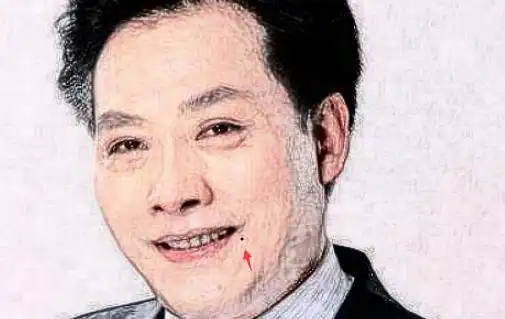 男人脸上五处桃花痣事业难行婚姻不顺出轨几率高