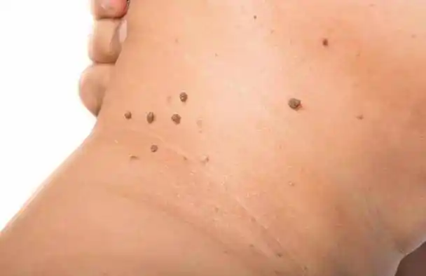 涨知识了_皮肤_医生_进行