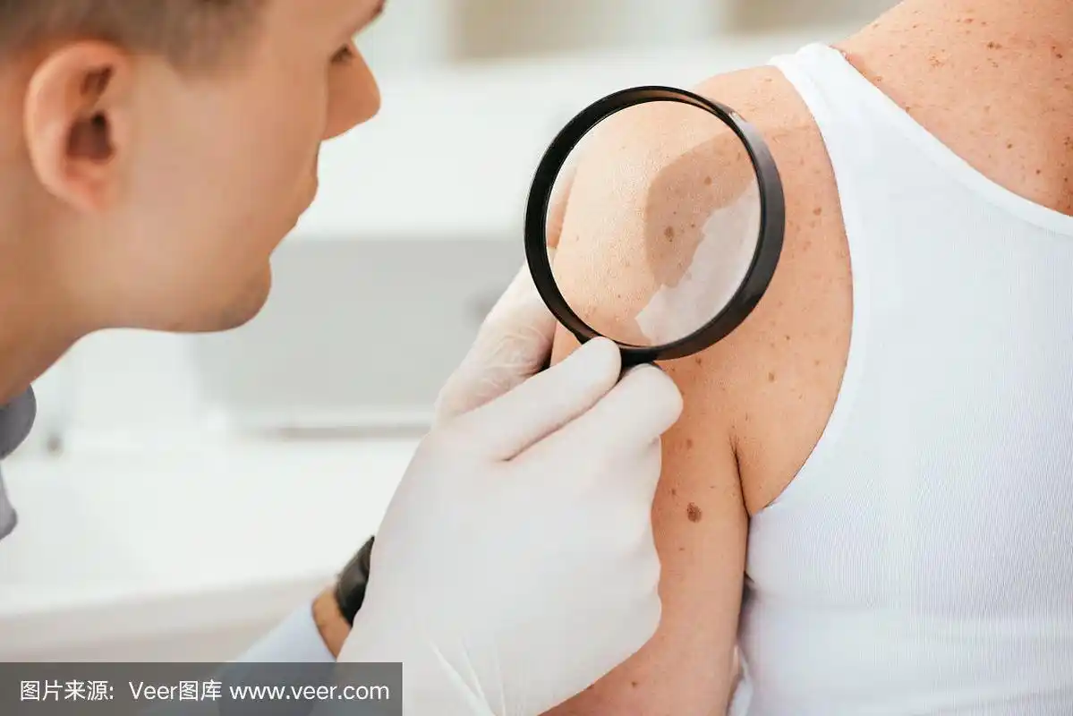 皮肤科医生在乳胶手套拿放大镜检查病人的皮肤病