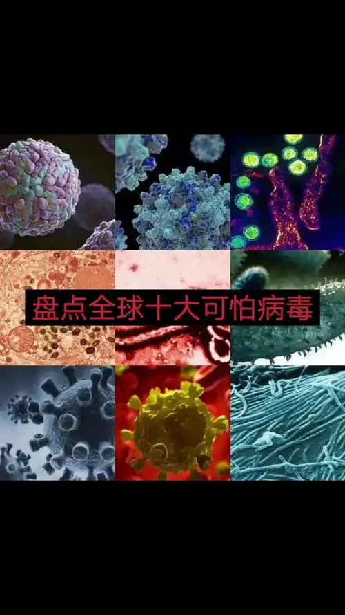 盘点全球十大可怕病毒