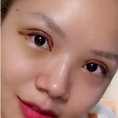 把钱花在割双眼皮上是值简直换了一个人