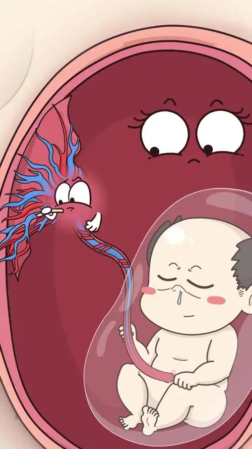 孕期控制体重也是很重要的#胎盘早剥