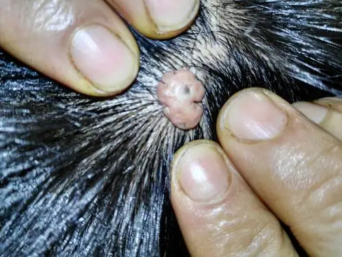 不疼不痒的.请帮忙看看这个什么原因造成的?该怎么处