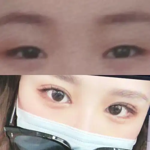 喜欢单眼皮还是双眼皮呀呀呀