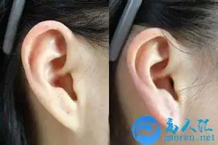 耳朵看相算命图解之没有耳垂的人面相分析