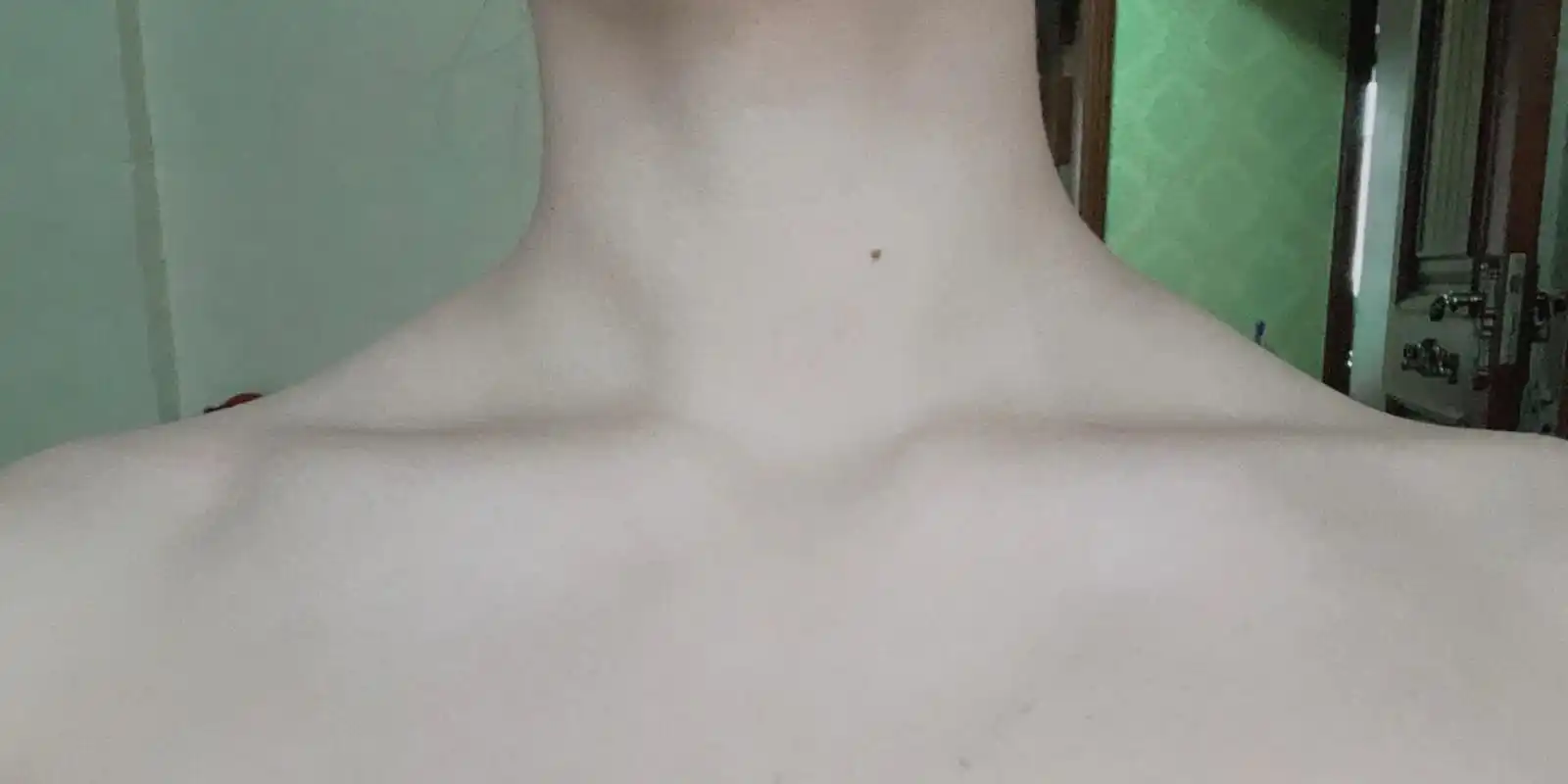 斜方肌中间鼓起来一块是什么东西啊救命 有在keep上跟练一些瘦肩缩