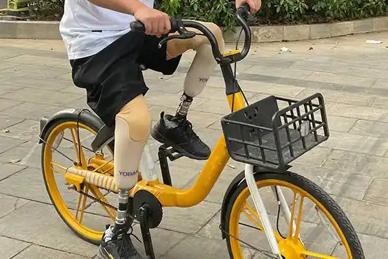 小腿假肢有哪些分类_进行_患者_股骨