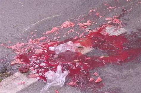 人被爆头脑浆图片2022已更新今日图集