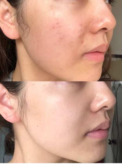 面膜干货皮肤太白是啥体验让人无限回购的美白面膜