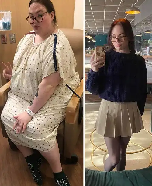 20张减肥前后对比照:每个胖妞都是潜力股,网友:这分明是换人