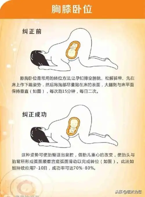 孕妇怎么样会导致胎位不正?孕期胎位不正担心无法顺产(7)