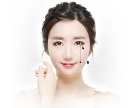 小酒窝小梨涡怎么分,想要后天拥有,医美可以做出来吗?