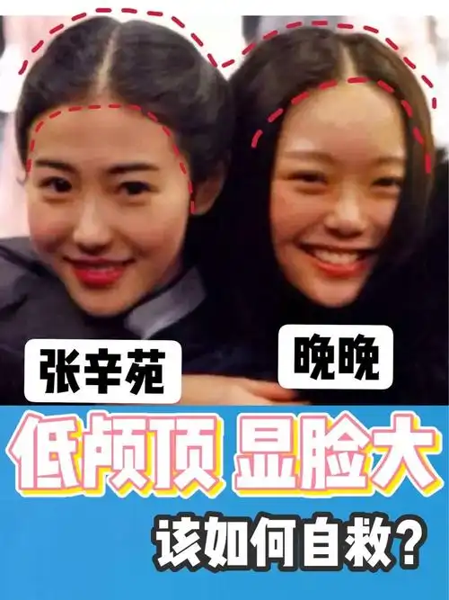 10个女生8个颅顶低