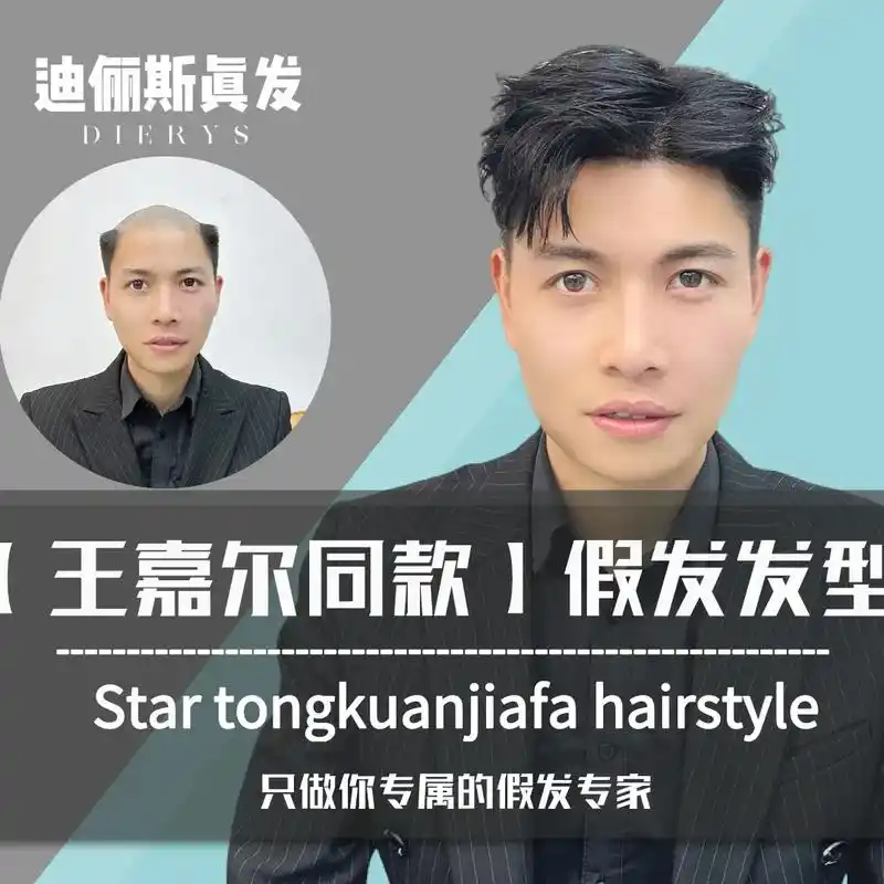 隐形头顶补发片99.这是一款帅气又时尚的男士全头假发片!