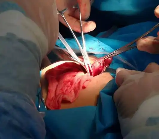 蒙自市中医院外科简介